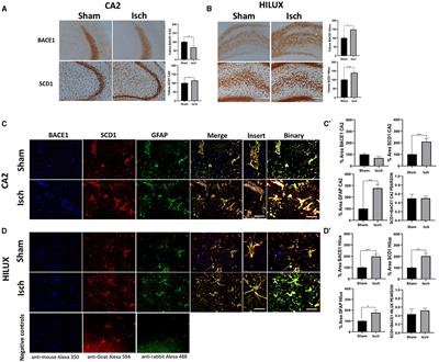 BACE1 and SCD1 are associated with neurodegeneration